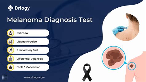diagnostic test for melanoma